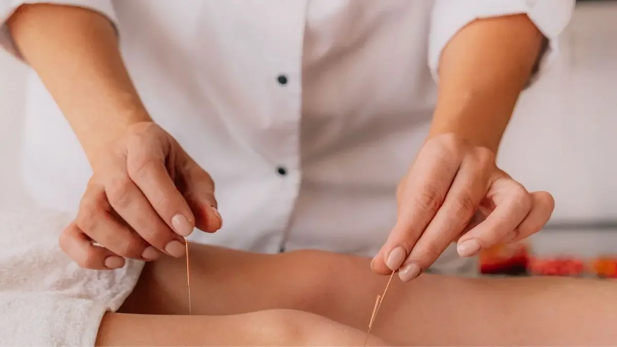 Acupuntura para artrose de joelho