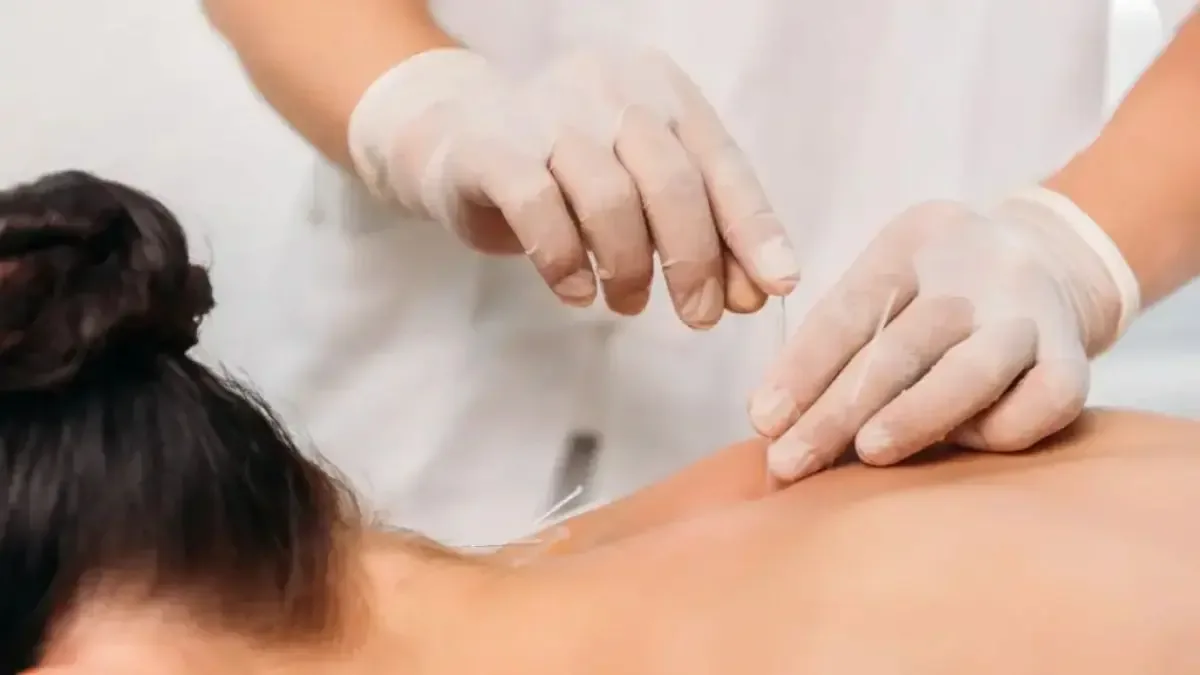 Clínica de acupuntura que aceita convênio