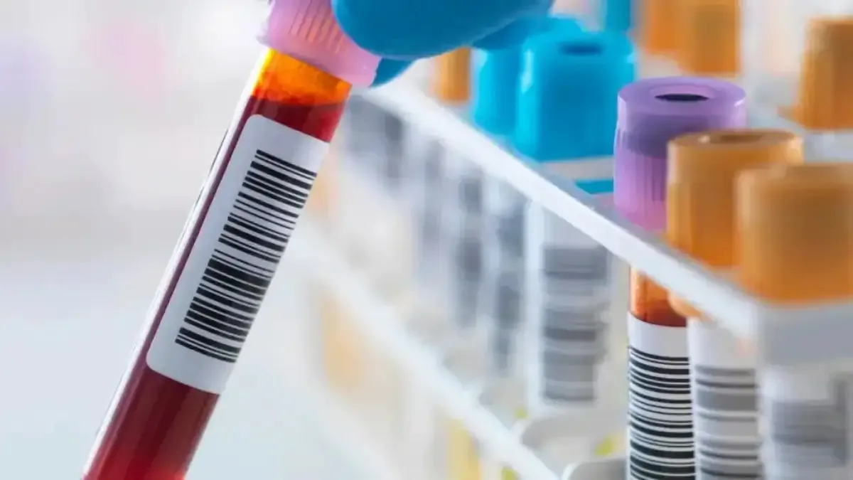 Por que o ortopedista pede exame de sangue